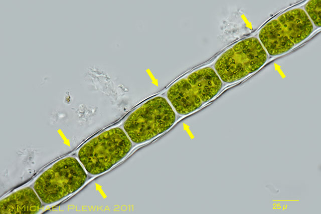 Leben im Teich Microspora sp. .(Chlorophyta)